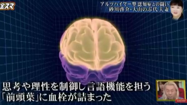 大山のぶ代、認知症07