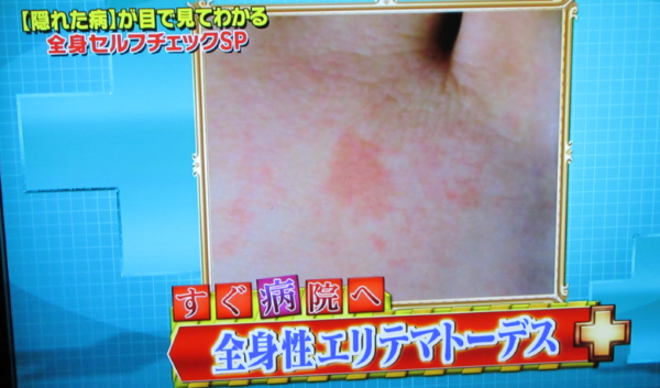 足に赤い斑点09