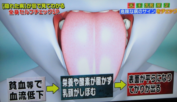 舌05
