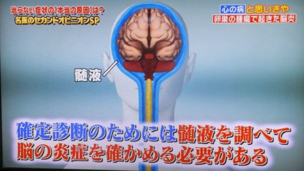 うつ症状に隠れた病気04